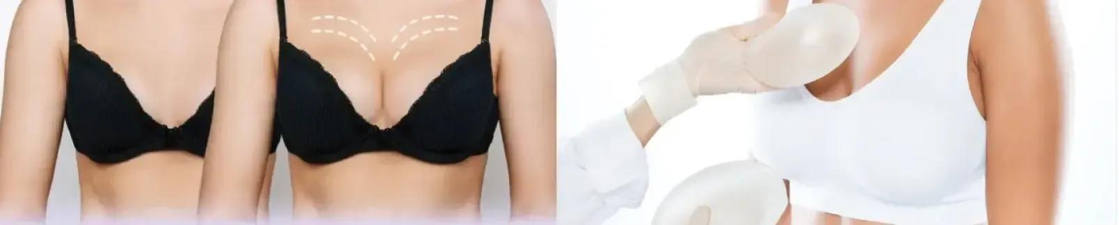 Breast Augmentation