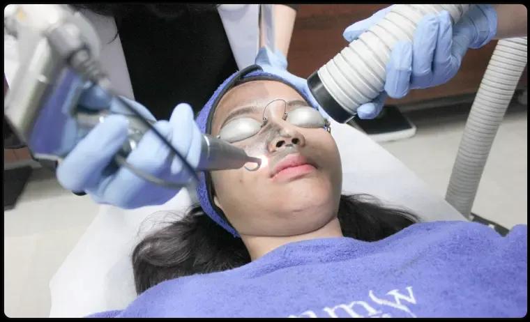 Hollywood Peel